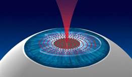 Femtosecond Lazer