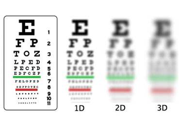 Lasik-PRK (Lazer Göz Cerrahisi) Hastalıklar