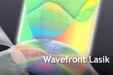 Wavefrontlasik