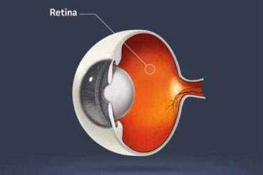 Retina Nedir